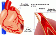 Pruebas para las cardiopatías